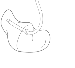 THIN TUBE HALF SHELL