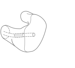 HIGH FREQUENCY NOISE FILTER